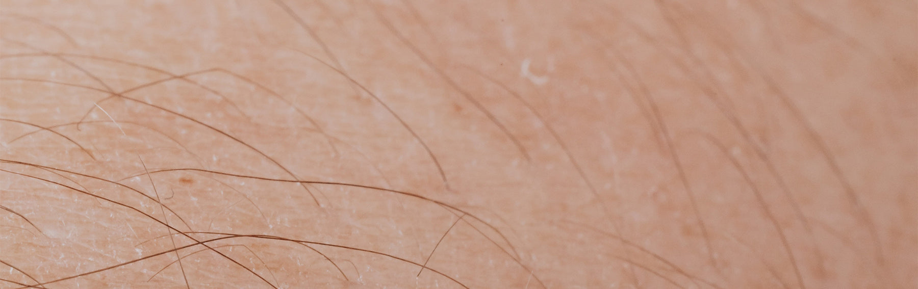 The Expert’s Guide to IPL Hair Removal: What You Need to Know