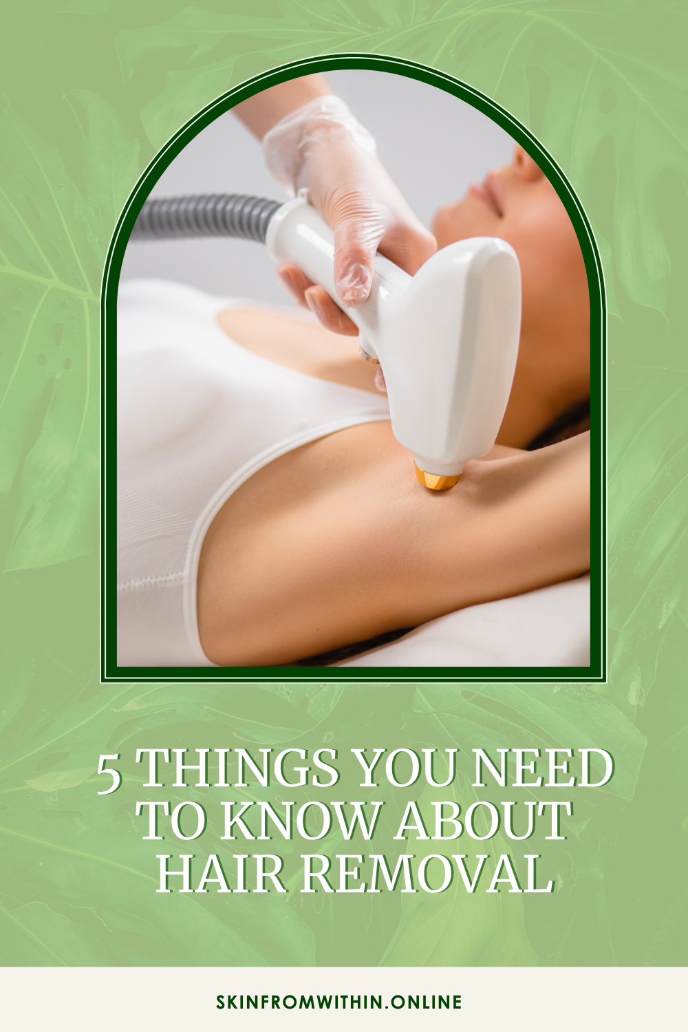 5 Things you need to know about IPL hair removal