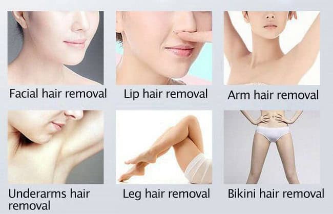 ND YAG vs Diode Laser: Comparison in Laser Hair Removal