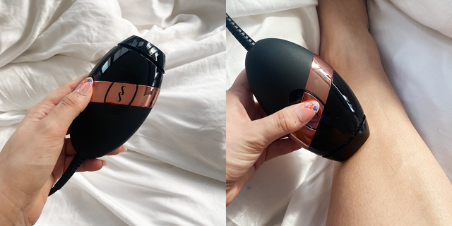 What Does Laser Hair Removal Atlanta Mean?