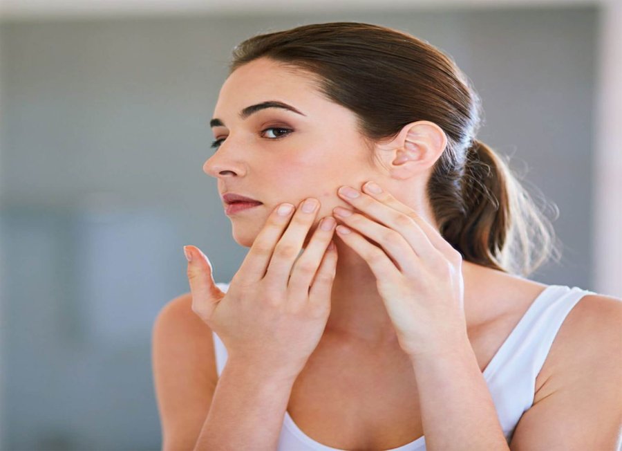 How Laser Treatment can Help Manage Acne Scars
