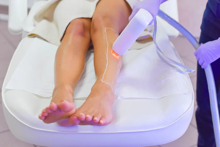 laser hair removal treatment
