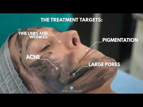 Hollywood Microdermabrasion