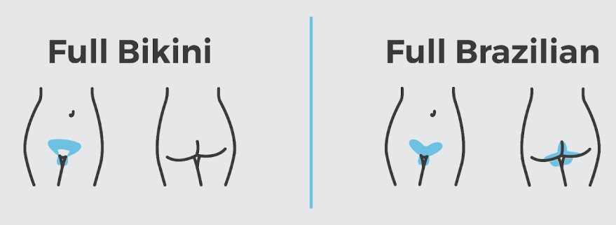 The Ultimate Comparison between Bikini vs Brazilian Laser Hair Removal