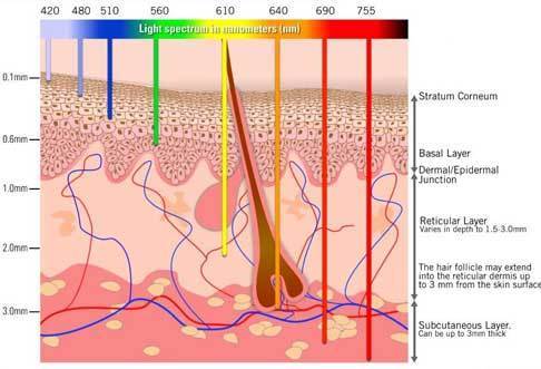 Why Choose Hair Removal from a Professional Laser Hair Removal Machine