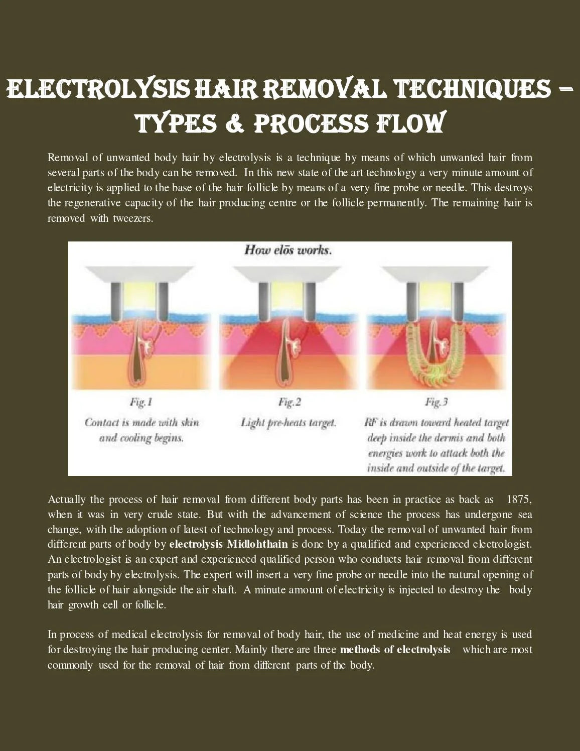 Laser Hair Removal