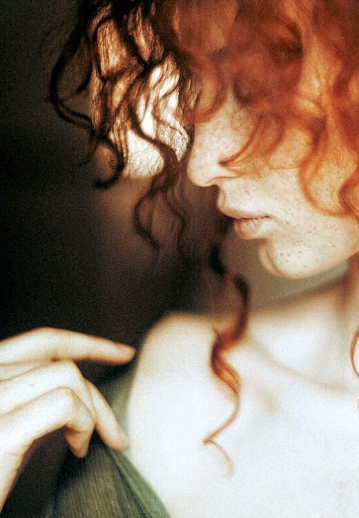 Can Redheads Get Laser Hair Removal?